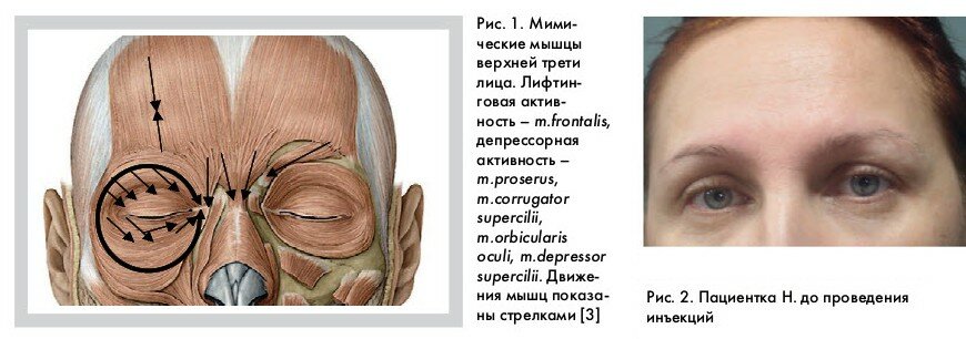Мимические мышцы верхней трети лица