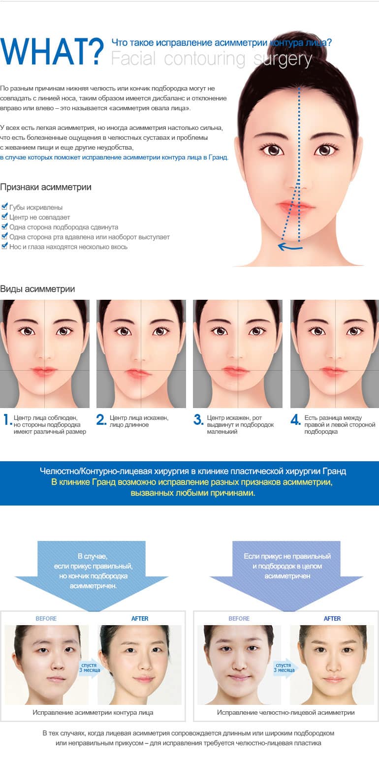 Как исправить асимметрию лица с помощью косметической хирургии антиоксиданты из капсул